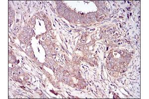 Immunohistochemistry (IHC) image for anti-Vitronectin (VTN) (AA 20-199) antibody (ABIN5542595)