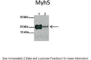 Lanes:   1: Mouse heart lysate, 2: Mouse skeletal muscle lysate  Primary Antibody Dilution:   1:1000  Secondary Antibody:   Anti-rabbit HRP  Secondary Antibody Dilution:   1:10000  Gene Name:   MYF5  Submitted by:   Anonymous (MYF5 抗体  (N-Term))