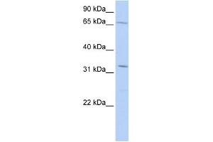 WB Suggested Anti-TRIM22 Antibody Titration:  0. (TRIM22 抗体  (Middle Region))