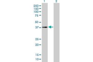 Western Blot analysis of CHI3L2 expression in transfected 293T cell line by CHI3L2 MaxPab polyclonal antibody. (CHI3L2 抗体  (AA 1-390))