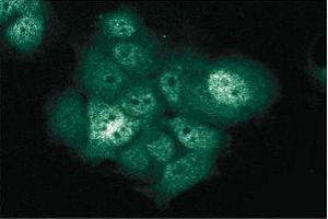 Immunofluorescent staining of MCF7 cells with anti-XIAP antibody. (XIAP 抗体  (AA 268-426))