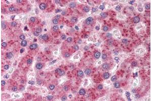 Human Liver (formalin-fixed, paraffin-embedded) stained with AKR1C4 antibody ABIN351481 at 2. (AKR1C4 抗体  (AA 2-14))
