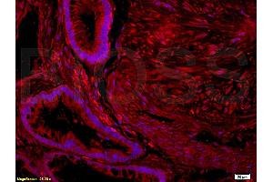 Formalin-fixed and paraffin embedded human placenta tissue labeled with  (ABIN725960)  Rabbit Anti-Nociceptin receptor Polyclonal Antibody at 1: 200 followed by incubation with conjugated secondary antibody and DAB staining. (OPRL1 抗体  (AA 1-47))