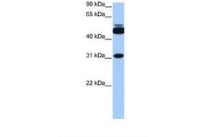 Image no. 1 for anti-Cylicin, Basic Protein of Sperm Head Cytoskeleton 2 (CYLC2) (C-Term) antibody (ABIN6738858)
