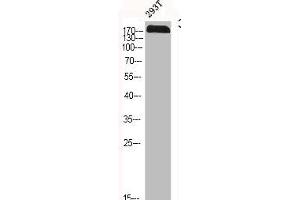 Western Blot analysis of 293T cells using CFTR Polyclonal Antibody