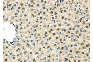 ABIN6263252 and ABIN6279536 at 1/100 staining Rat liver tissue by IHC-P. (m1ip1 抗体  (Internal Region))