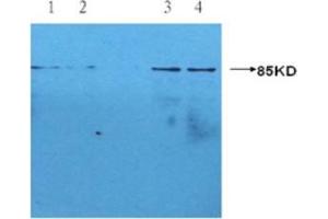 Western blotting using Mouse anti-human CRP monoclonal antibody (S5G1) at 1:1000 dilution.