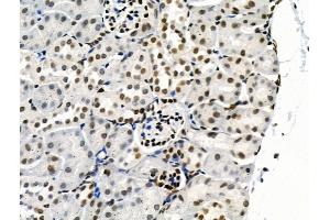 Phospho-SRPK2 (Thr492) Antibody at 1/100 staining Mouse kidney tissue by IHC-P. (SRPK2 抗体  (pThr492))