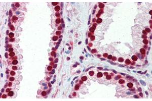 Immunohistochemistry (IHC) image for anti-Sjogren Syndrome Antigen B (SSB) (N-Term) antibody (ABIN2778846)