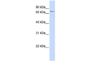 WB Suggested Anti-ZNF442 Antibody Titration: 0. (ZNF442 抗体  (Middle Region))