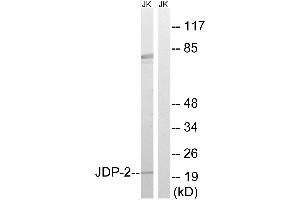 Western blot analysis of extracts from Jurkat cells, using JDP-2 (Ab-148) antibody. (JDP2 抗体  (Thr148))