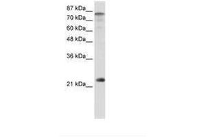 Image no. 1 for anti-Nuclear Transcription Factor Y, beta (NFYB) (N-Term) antibody (ABIN6736220) (NFYB 抗体  (N-Term))