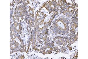 IHC analysis of ATX2/ATXN2 using anti-ATX2/ATXN2 antibody (ABIN3043507). (Ataxin 2 抗体  (C-Term))