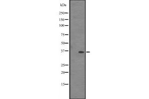 Western blot analysis of IN35 expression in HEK293 cells ,The lane on the left is treated with the antigen-specific peptide. (IFI35 抗体  (C-Term))