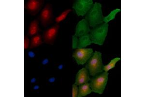 ABIN6257317 and ABIN6275836 staining  cells by IF/ICC.