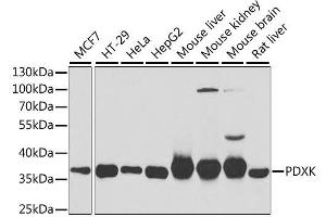 Western blot analysis of extracts of various cell lines, using PDXK antibody. (PDXK 抗体  (AA 1-312))