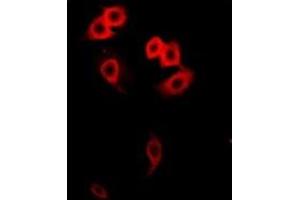 Immunofluorescent analysis of GalNAc-T2 staining in Hela cells. (GalNAc-T2 抗体)