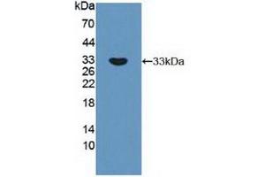 Detection of Recombinant RPS6Kb1, Human using Polyclonal Antibody to Ribosomal Protein S6 Kinase Beta 1 (RPS6Kb1) (RPS6KB1 抗体  (AA 91-352))