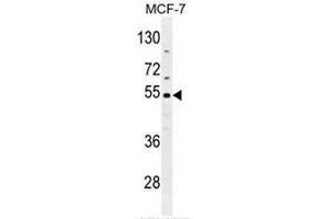 CES2 Antibody (Center) western blot analysis in MCF-7 cell line lysates (35µg/lane). (CES2 抗体  (Middle Region))