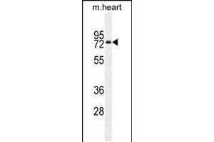 Western blot analysis in mouse heart tissue lysates (35ug/lane). (Otopetrin 1 抗体  (AA 360-388))