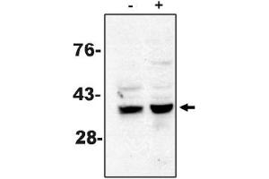 Western Blotting (WB) image for anti-Caspase 7, Apoptosis-Related Cysteine Peptidase (CASP7) antibody (ABIN264418) (Caspase 7 抗体)