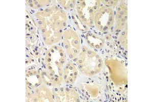 Immunohistochemistry of paraffin-embedded human kidney using UBE2Z antibody at dilution of 1:100 (40x lens). (UBE2Z 抗体)