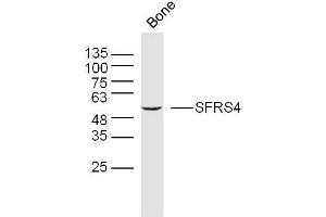Mouse bone lysates probed with SFRS4 Polyclonal Antibody, Unconjugated  at 1:300 overnight at 4˚C. (SRSF4 抗体  (AA 1-100))