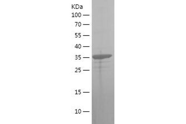 HSD17B10 Protein (AA 43-146) (His-IF2DI Tag)
