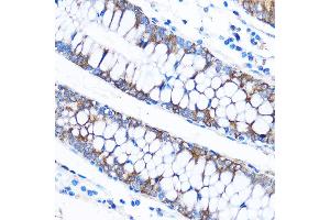 Immunohistochemistry of paraffin-embedded Human colon using C Rabbit pAb (ABIN7266006) at dilution of 1:50 (40x lens). (CABP1 抗体)