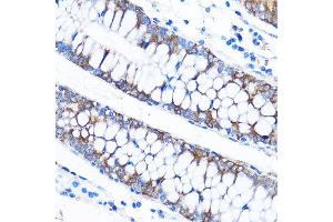 Immunohistochemistry of paraffin-embedded Human colon using C Rabbit pAb (ABIN7266006) at dilution of 1:50 (40x lens).