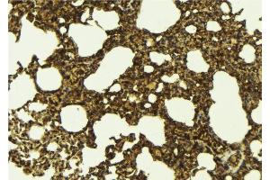 ABIN6276704 at 1/100 staining Mouse lung tissue by IHC-P. (PRMT5 抗体  (Internal Region))
