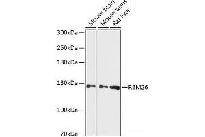 Western blot analysis of extracts of various cell lines using RBM26 Polyclonal Antibody at dilution of 1:3000. (RBM26 抗体)