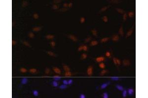 Immunofluorescence analysis of NIH/3T3 cells using ZEB2 Polyclonal Antibody at dilution of 1:100. (ZEB2 抗体)