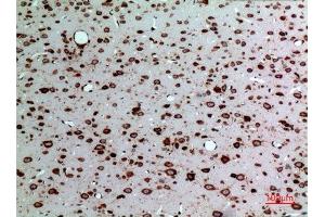 Immunohistochemistry (IHC) analysis of paraffin-embedded Rat Brain, antibody was diluted at 1:100. (Midkine 抗体  (Internal Region))