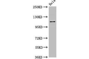 Western Blot Positive WB detected in: Hela whole cell lysate All lanes: SEC23IP antibody at 2. (SEC23IP 抗体  (AA 779-989))