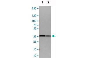 Western blot analysis of cell lysates with ARPC1B polyclonal antibody . (ARPC1B 抗体)