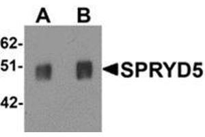Western blot analysis of SPRYD5 in rat brain tissue lysate with SPRYD5 antibody at (A) 0. (TRIM51 抗体  (C-Term))