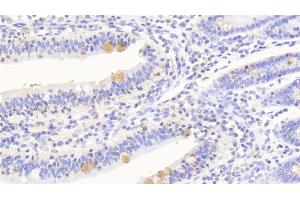 Immunohistochemistry (IHC) image for anti-serpin Peptidase Inhibitor, Clade A (Alpha-1 Antiproteinase, Antitrypsin), Member 10 (SERPINA10) (AA 24-444) antibody (ABIN7434527)