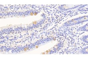 Detection of SERPINA10 in Human Small intestine Tissue using Polyclonal Antibody to Serpin A10 (SERPINA10) (SERPINA10 抗体  (AA 24-444))