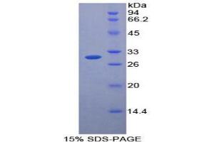 SDS-PAGE analysis of Mouse Protease, Serine 12 Protein. (Protease 蛋白)