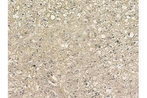 ABIN6255414 and ABIN6267211 at 1/100 staining human normal liver tissue by IHC-P. (Calnexin 抗体  (pSer564))