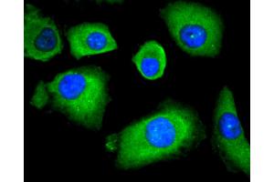 A549 cells were stained with HDAC4 (6B10) Monoclonal Antibody  at [1:200] incubated overnight at 4C, followed by secondary antibody incubation, DAPI staining of the nuclei and detection. (HDAC4 抗体)