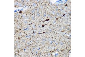 Immunohistochemistry (IHC) image for anti-Calbindin 2 (CALB2) (AA 1-271) antibody (ABIN6137849)