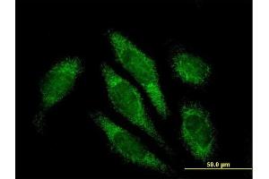 Immunofluorescence of purified MaxPab antibody to ALDH16A1 on HeLa cell. (ALDH16A1 抗体  (AA 1-802))