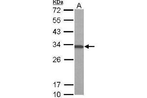 Western Blotting (WB) image for anti-ATPase, H+ Transporting, Lysosomal 31kDa, V1 Subunit E1 (ATP6V1E1) (Center) antibody (ABIN2855175)
