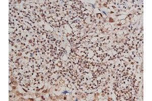 Immunohistochemistry (IHC) image for anti-Fms-Related tyrosine Kinase 1 (VEGFR1) (FLT1) (pTyr1213) antibody (ABIN6256626)