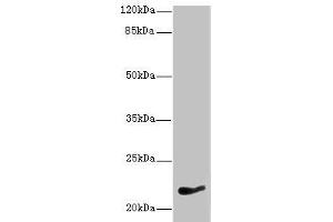 Western blot All lanes: NKIRAS1 antibody at 7 μg/mL + HepG2 whole cell lysate Secondary Goat polyclonal to rabbit IgG at 1/10000 dilution Predicted band size: 22 kDa Observed band size: 22 kDa (NKIRAS1 抗体  (AA 1-192))