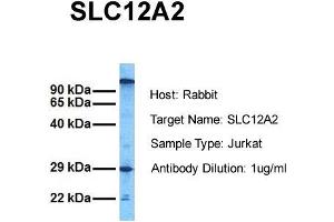 Western Blotting (WB) image for anti-Solute Carrier Family 12 (Potassium-Chloride Transporter) Member 2 (SLC12A2) (C-Term) antibody (ABIN2773831)