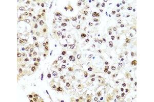 Immunohistochemistry (Paraffin-embedded Sections) (IHC (p)) image for anti-Tet Methylcytosine Dioxygenase 2 (TET2) antibody (ABIN7261632)