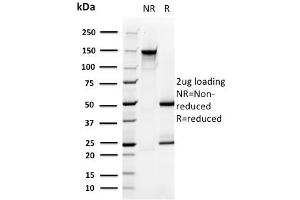 SDS-PAGE Analysis Purified PMEPA1 Mouse Monoclonal Antibody (PMEPA1/2696). (PMEPA1 抗体)